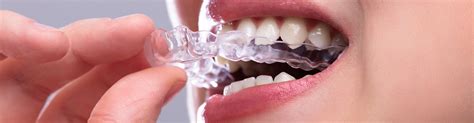 Invisible Clear Braces Dubai Uae Teeth Straightening Treatment
