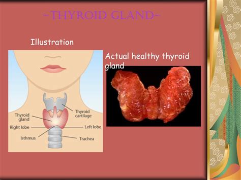 Ppt Thyroid Gland Powerpoint Presentation Free Download Id3035538
