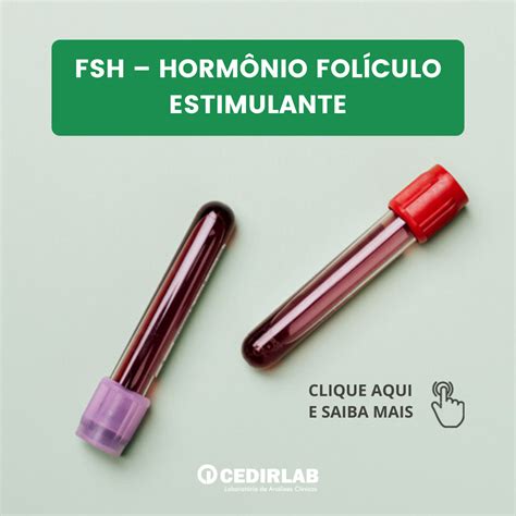 FSH Hormônio Folículo Estimulante Cedirlab