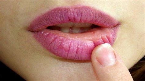 Sering Jadi Pertanda Baik Ini Arti Kedutan Bibir Atas Menurut Primbon
