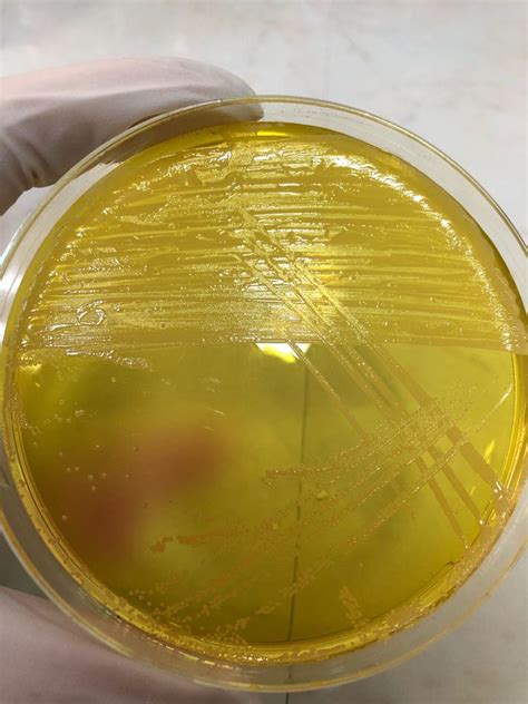 Staphylococcus Aureus On Mannitol Salt Agar Medizzy