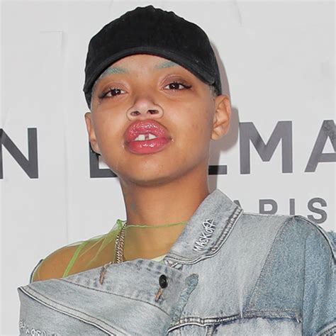 Model Slick Woods Says Her Life Was Saved After Suffering Seizure E