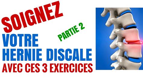 Exercices Pour Soigner Une Hernie Discale Partie YouTube