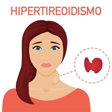 Hipertireoidismo Antes E Depois