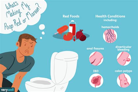 Always make an appointment with your veterinarian if your cat is passing blood in the stool. Why Your Poop May Be Red or Maroon