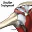 Impingement Syndrome  Brisbane Knee And Shoulder ClinicBrisbane