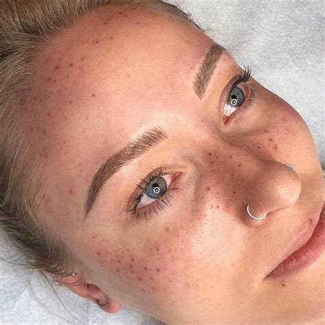 Full Face Freckles By Shaughnessy Freckles If You Are