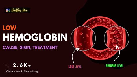 Low Hemoglobin Symptoms Causes And The Road To Recovery Youtube