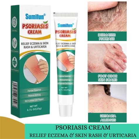 Authentic Psoriasis Eczema Cream Antibacterial Anti Itching Herbal Dermatitis Treatment