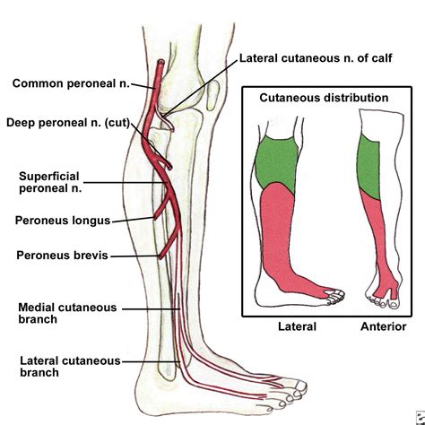 Doctors Gates Foot Drop Causes And Treatment