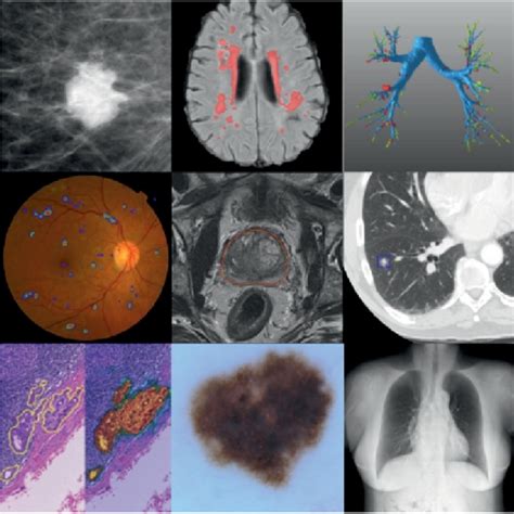 Introduction To Biomedical Imaging Using Deep Learning By Susant