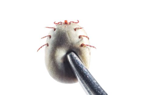 Removing Tick With Tweezers Stock Photos Pictures And Royalty Free