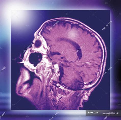 Normal Head And Brain Mri Scan — Scanner Biological Stock Photo