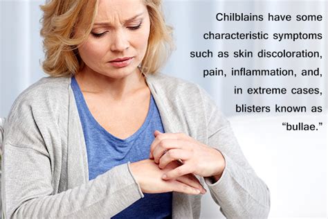 Chilblains Causes Symptoms And Treatment Emedihealth