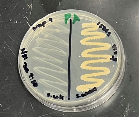 Solved Place The Image Of Your Phenylethyl Alcohol Agar Plate What