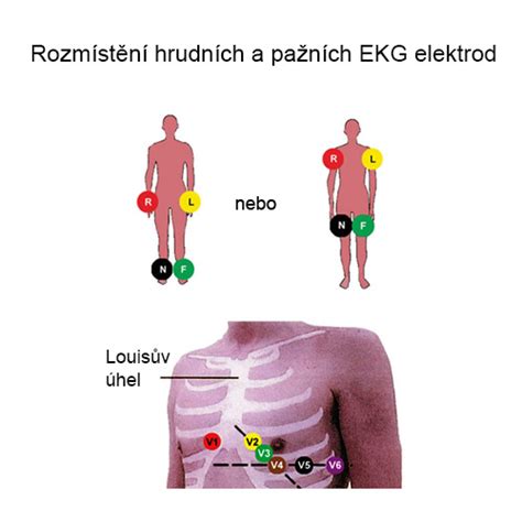 It is a graph of voltage versus time of the electrical activity of the heart using electrodes placed on the skin. EKG ELEKTRODY (končetinové ECG klipsy) | Zdravotnická ...