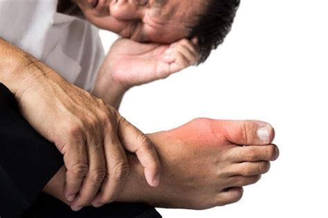 Patient Continues To Insist He Suffers From “the Gouch” Not Gout