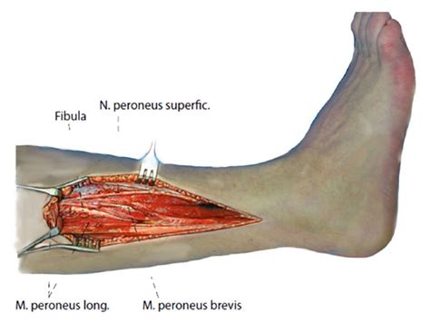 Lateral Leg Muscle Diagram Human Leg Wikipedia Editable Vector