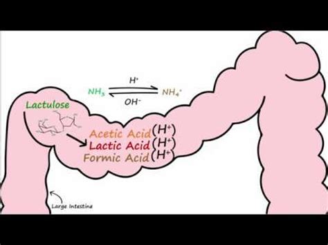 Steiner}, journal={journal of veterinary objective to comparatively review the pathogenesis, clinical presentation, diagnosis, and management of hepatic encephalopathy (he) in. Hepatic Encephalopathy and Lactulose - YouTube