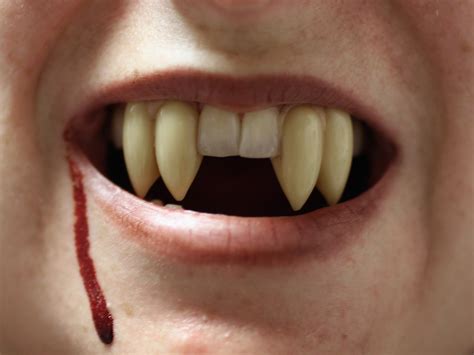 How To Get Vampire Teeth For Real Diy Realistic Custom Fit Fangs Step By Step I Keep