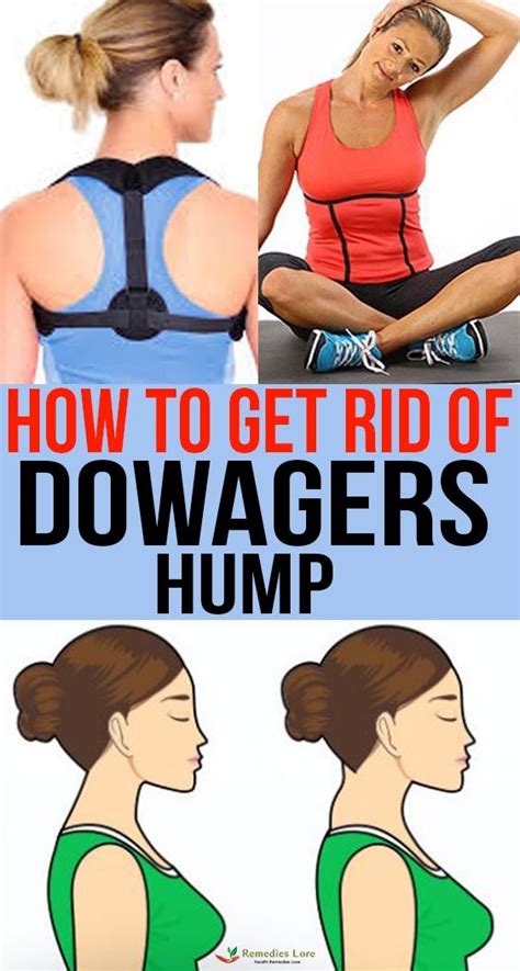 How To Get Rid Of Dowagers Hump Dowager Hump Neck Exercises Exercise