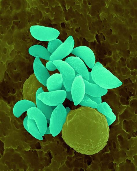 Parasitic Protozoan Tachyzoites Photograph By Dennis Kunkel Microscopy
