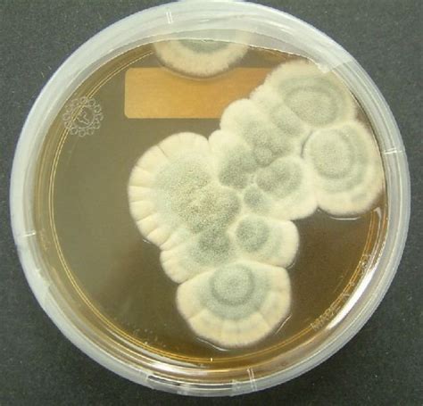 Penicillium ~ Everything You Need To Know With Photos Videos