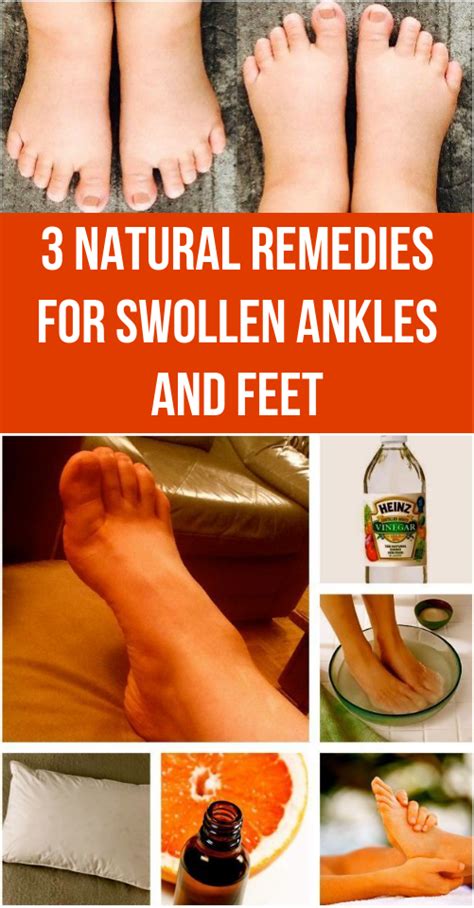 3 Natural Remedies For Swollen Ankles And Feet Healthy Lifestyle