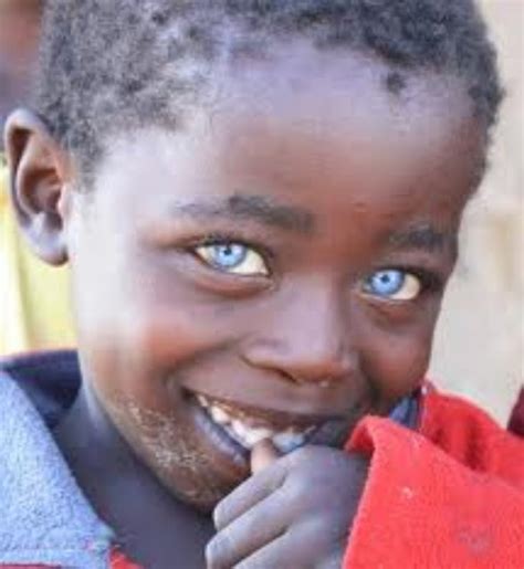 Blacks With Blue Eyes Natural Phenomenon Or Genetic Mutation