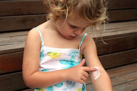 3 Tips For Treating Eczema On Children Scholastic Parents
