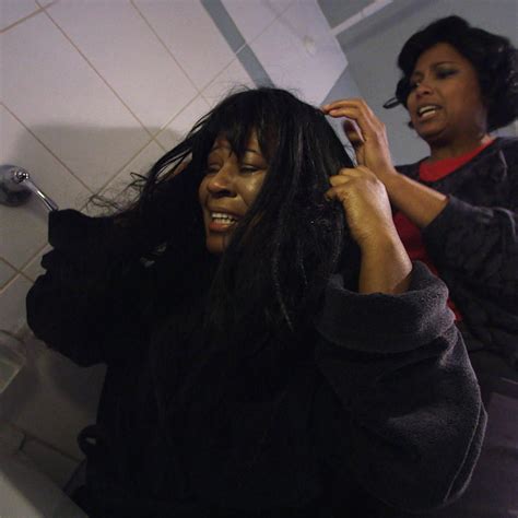 Fingernails Growing Out of Her Head | Diagnose Me ...