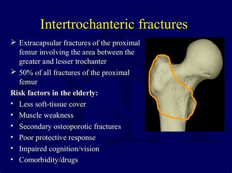 Dhs Vs Pfna For Intertrochanteric Fractures Dr Chintan N Patel