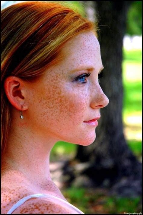 Twitter Beautiful Freckles Freckles Girl Red Freckles