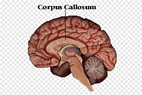 Corpus callosum Brain Corpus callosotomy Hémisphère cérébral Corps