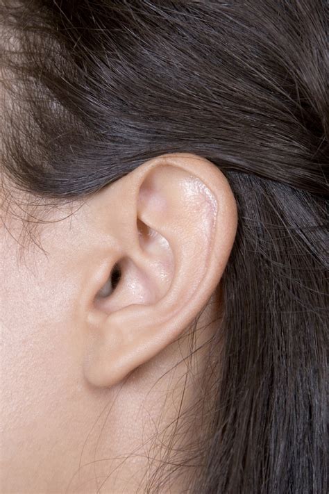 Malformed Ears Doctor Answers
