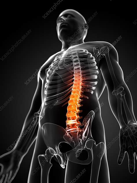 Back Pain Conceptual Artwork Stock Image F0062931 Science Photo