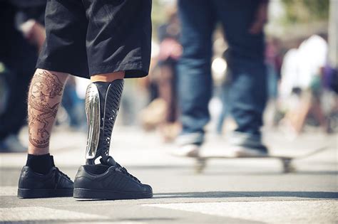 These D Printed Covers Make Prosthetics Stylish Co Exist Ideas Impact