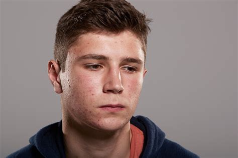 Teenage Boy With Acne Looking Down Head And Shoulders Portrait Stock