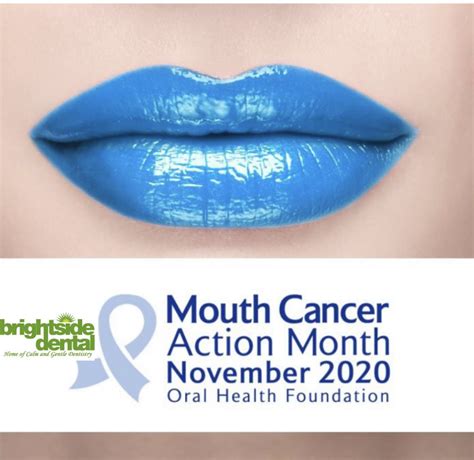 Mouth Cancer Action Month 2020 Dentist In Bounds Green Dental Blog