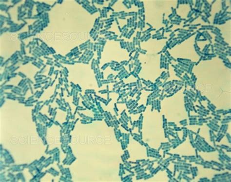 Photograph Bacillus Cereus Science Source Images