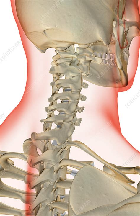 The Bones Of The Neck Stock Image F0016046 Science Photo Library