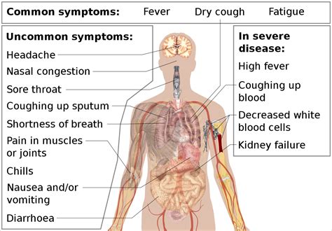 Simptome coronavirus Cele 14 semne la care să fii atent