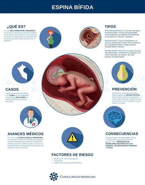 Consejos Para Prevenir La Espina Bífida Durante El Embarazo Vida Peru21