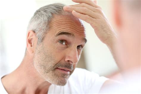 Mens Hair Loss Treatment Men Baldness Remedies And Results
