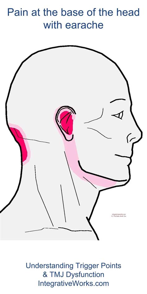 Headache At Base Of Skull Headache Behind The Ear Signs Causes And