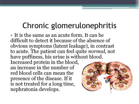 Acute And Chronic Glomerulonephritis Online Presentation
