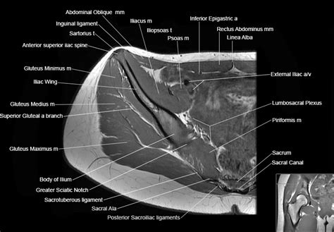 Hip MRI Anatomy