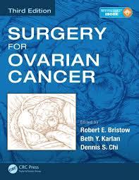 Lower back pain is not a very common symptom related to ovarian cancer, but depending on the size and location of the tumor, it can push structures around, resulting in pain. Signs and Symptoms of Ovarian Cancer Research Papers