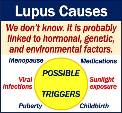 What Is Lupus Symptoms Causes Diagnosis And Treatment Mbn Health