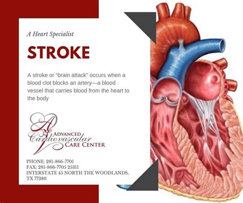 Pin On Causes Of Stroke Houston Cardiologist
